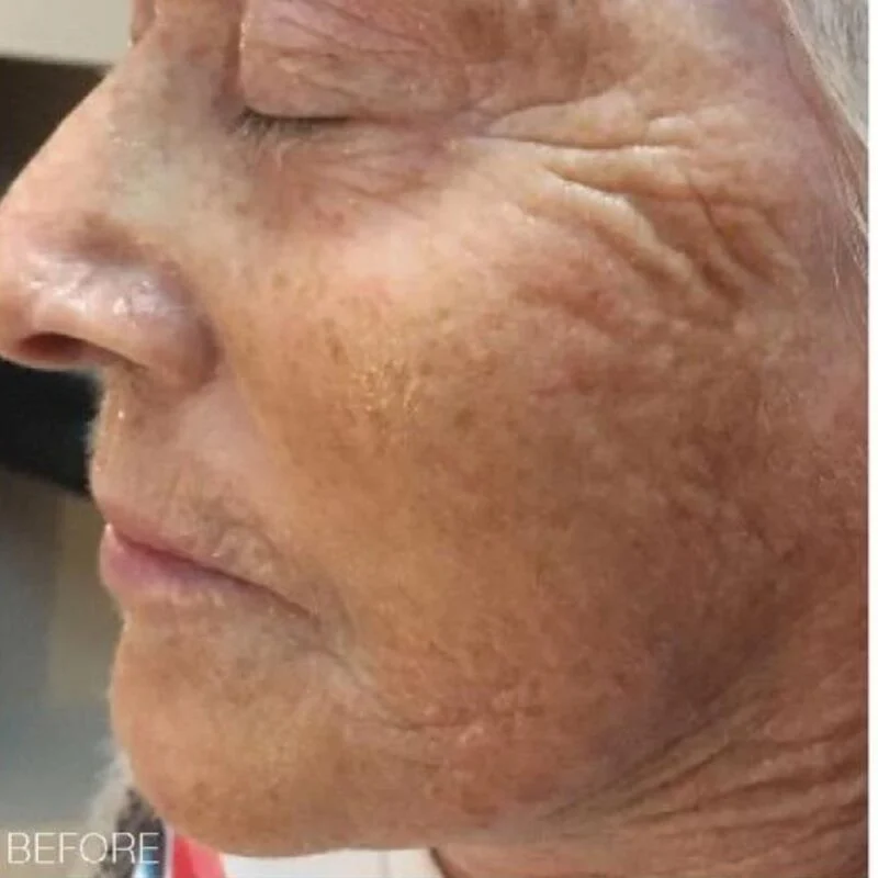 bt-sculpt GEN1 Microcurrent Facial Device – Bio-Therapeutic Facial Sculpting System – view 4