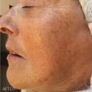 bt-sculpt GEN1 Microcurrent Facial Device – Bio-Therapeutic Facial Sculpting System – view 5