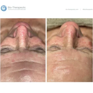 BT-BEFOREANDAFTER-ALL-WEB-REV06252524_bbb2dfc1-6cf5-480a-9e34-f57ecd059d40 microcurrent facial device,facial toning device,at home microcurrent,facial sculpting device,Bio-Therapeutic microcurrent,handheld facial device,EMS facial toning,facial lifting device,professional microcurrent device,skin firming device,bt sculpt gen2,bt sculpt gen2 microcurrent facial lifting